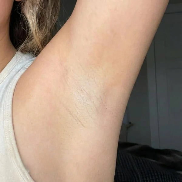 2. REGARDER LE PEELING !