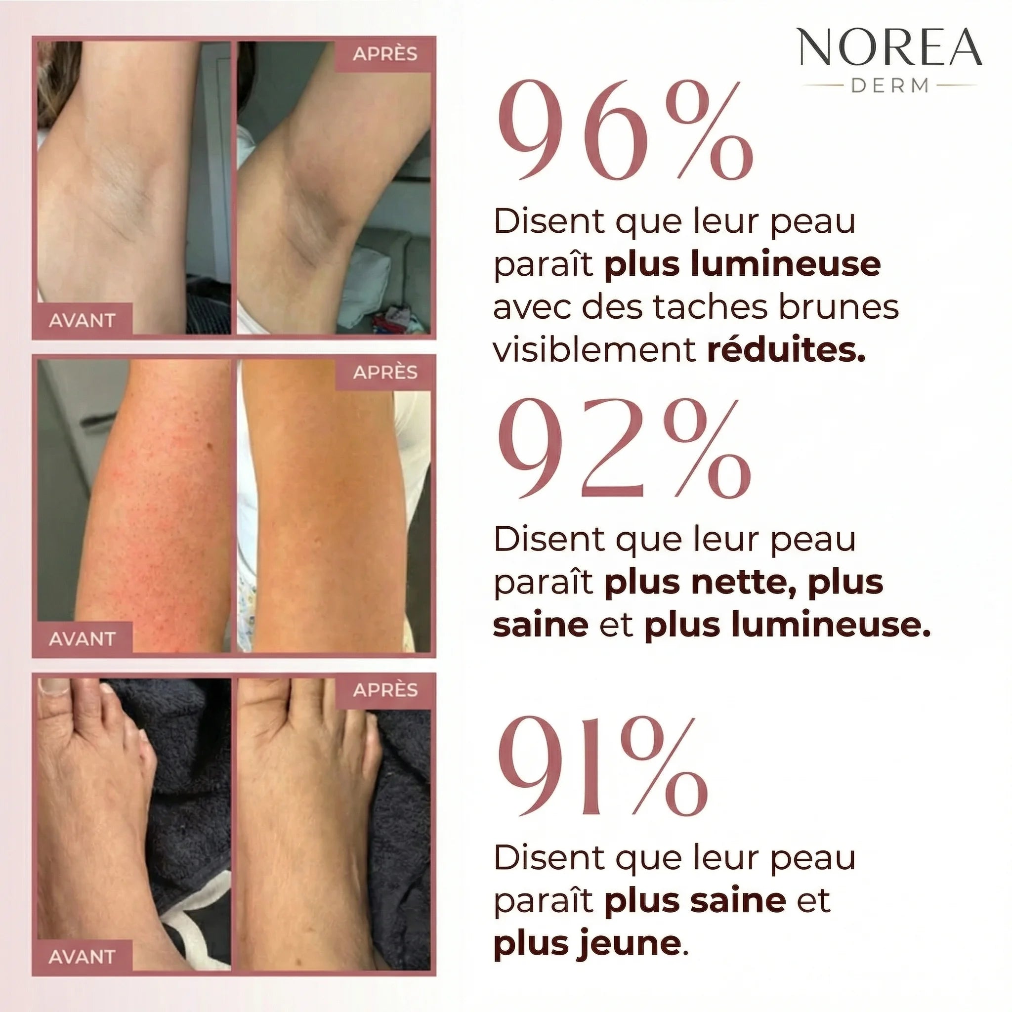 Norea Peel Shot Kojique + Curcuma