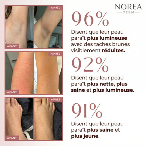 Norea Peel Shot Kojique + Curcuma